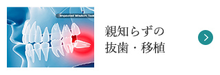 親知らずの抜歯・移植