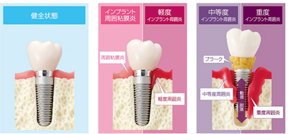 アフターケアや定期メンテナンス